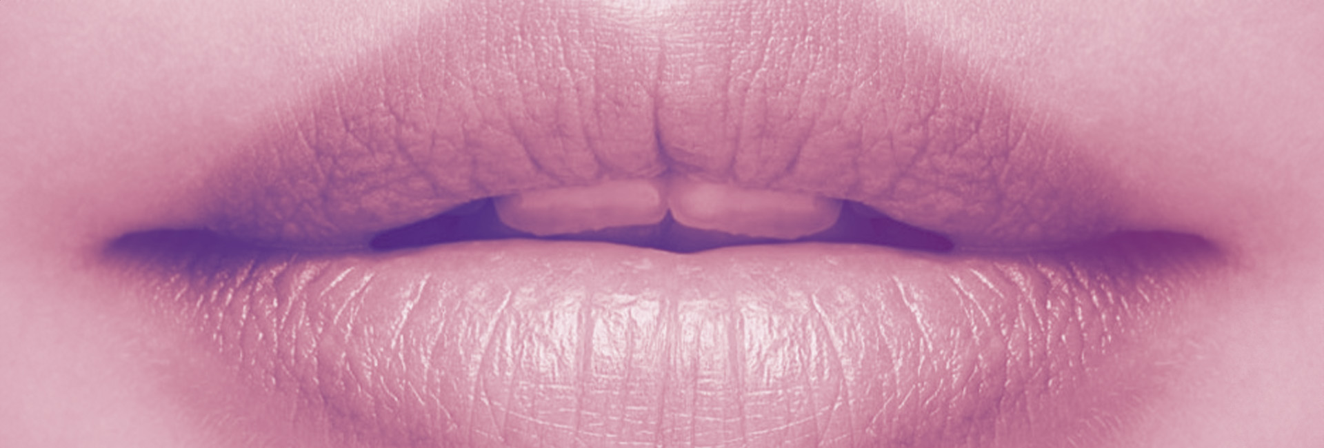 Filler Labbra — Day 2
